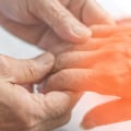 Neuropathy treatments for hands?