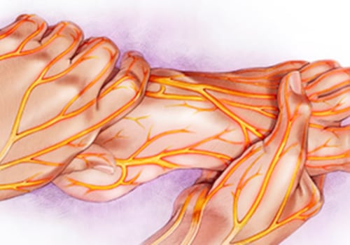 How can I reverse neuropathy naturally?